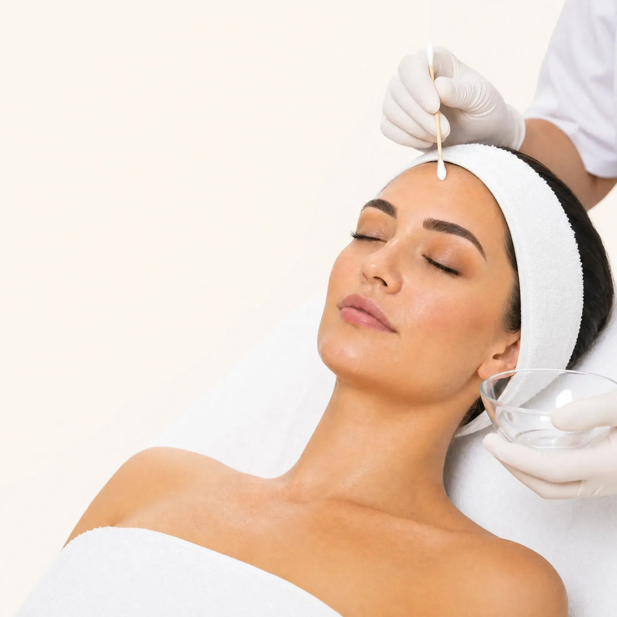 Chemical Peels