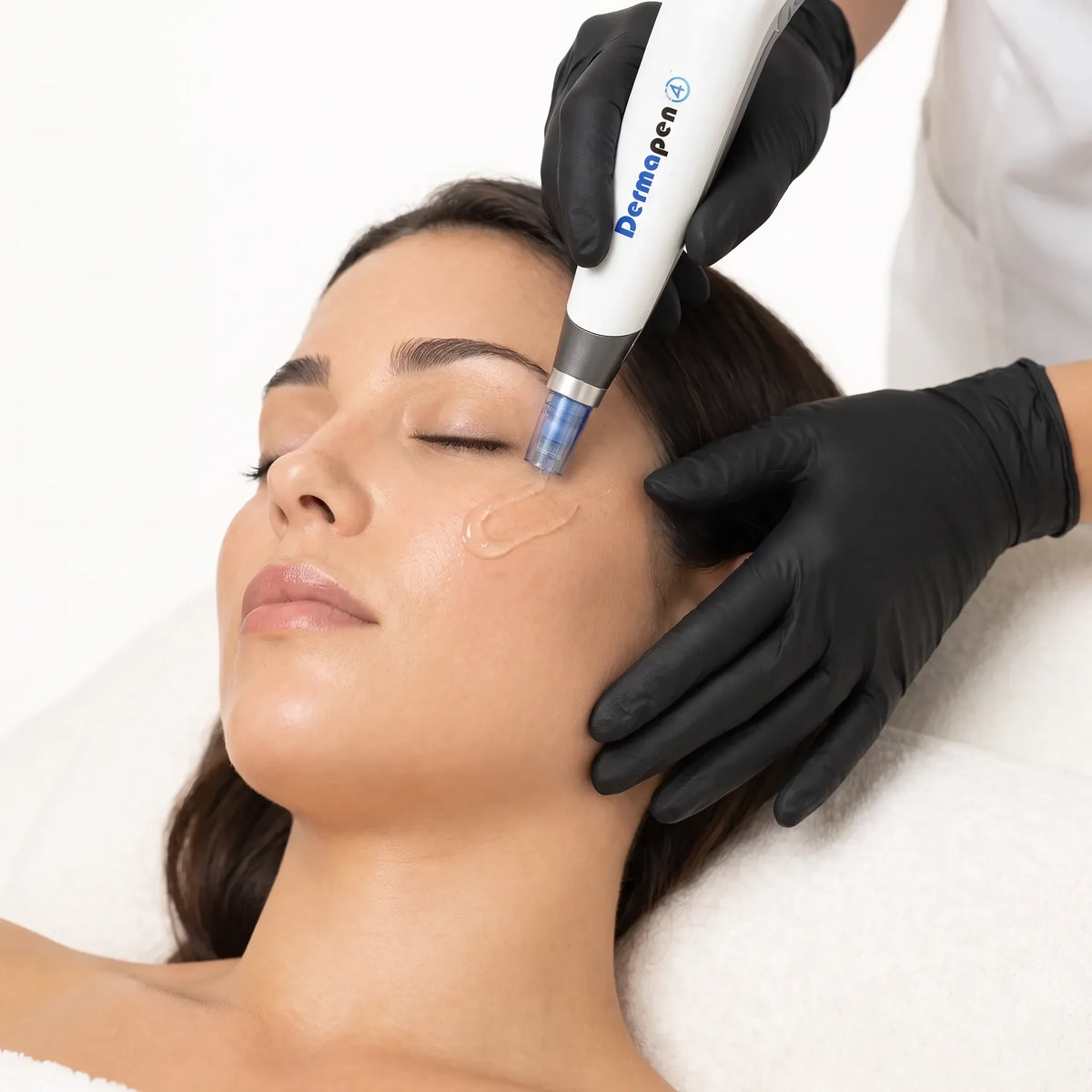 Micro-needling