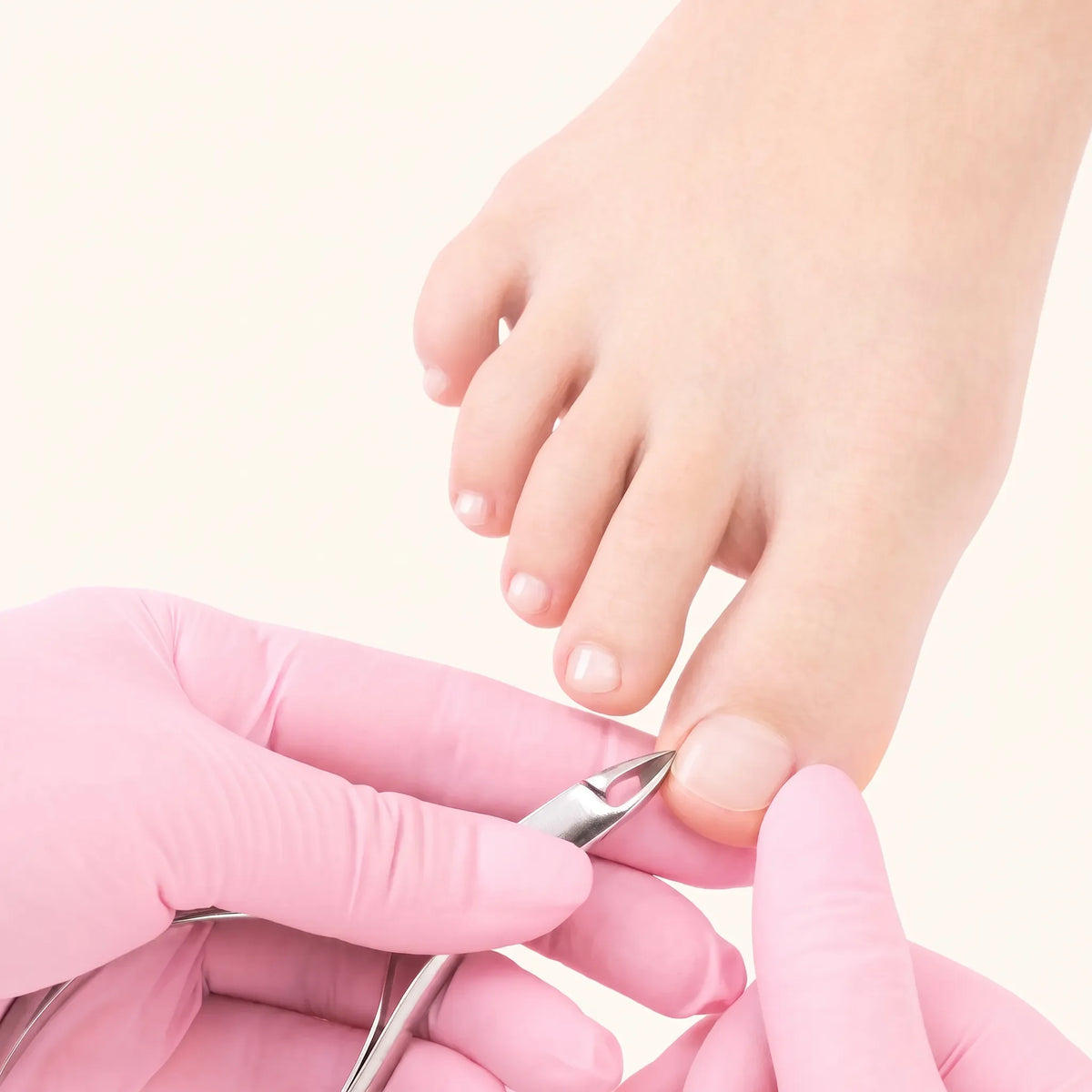 Toe Nail Reconstruction