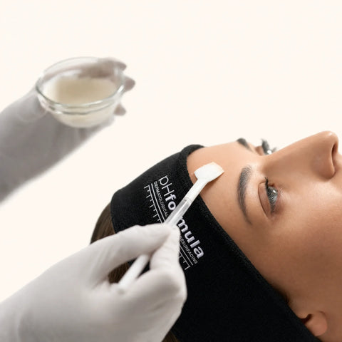pHFormula Dermabrasion Facial Treatment