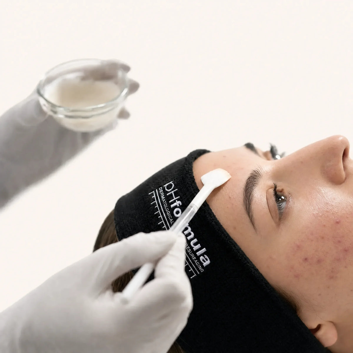 pHformula AC Facial Treatment