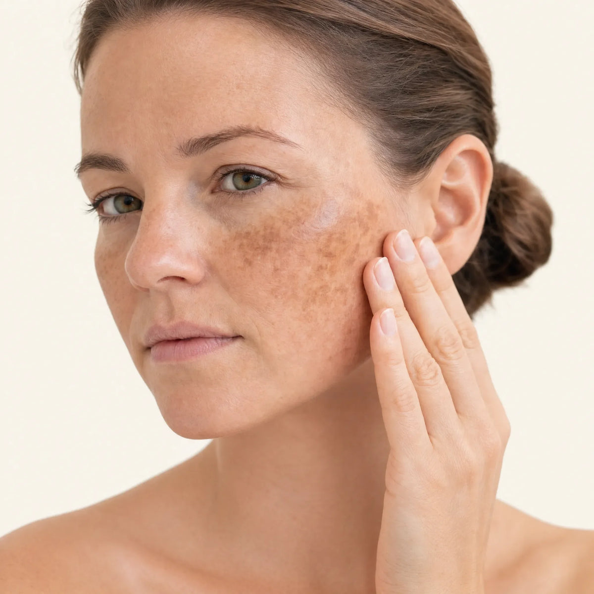 Pigmentation treatments