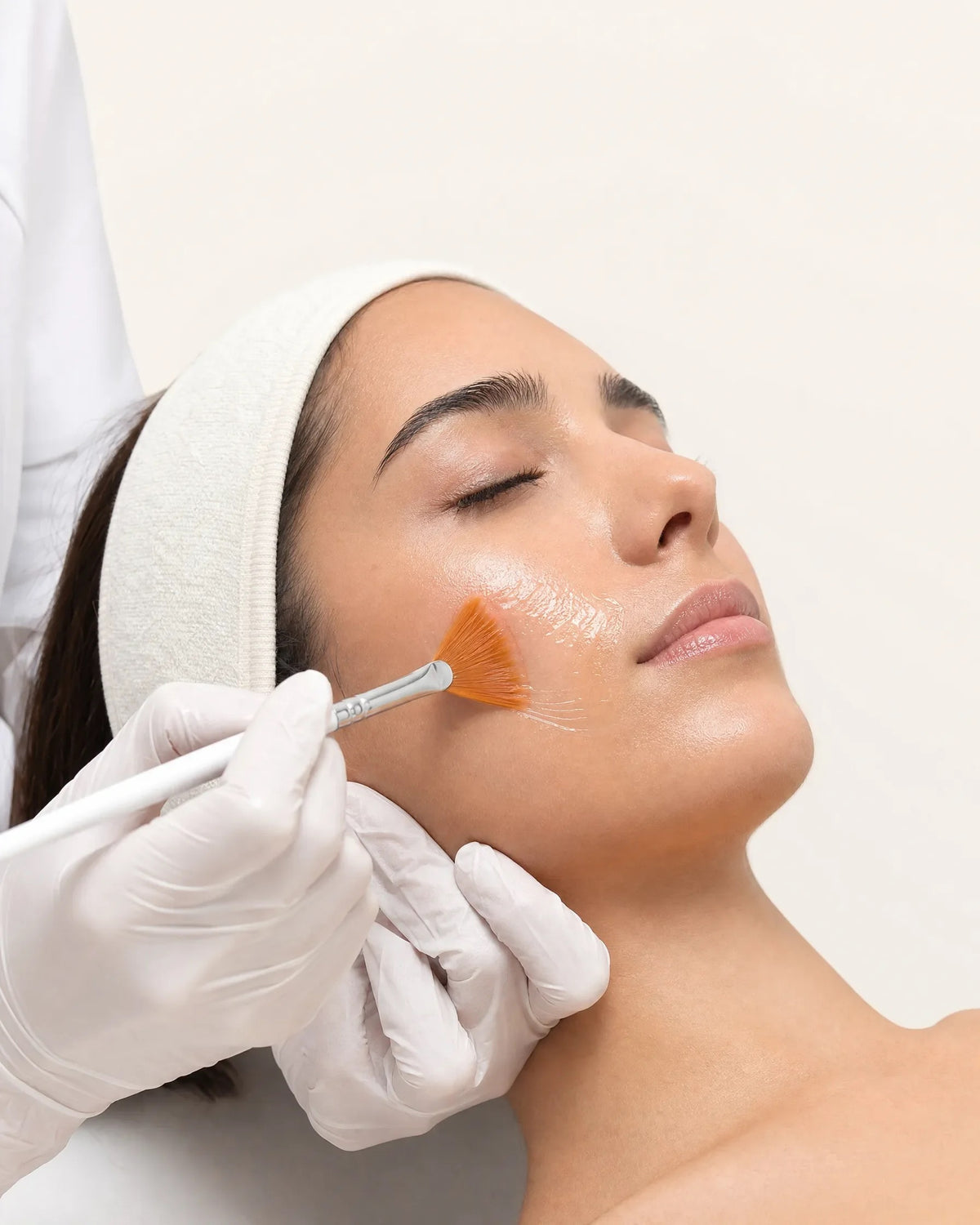 Even film of peel solution on the cheek during treatment